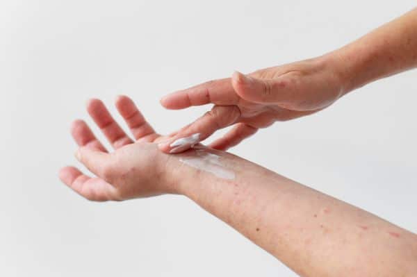 Dermofarmacia - problemas de piel seca