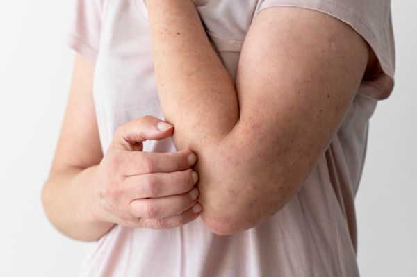 Dermofarmacia - problemas de piel sensible